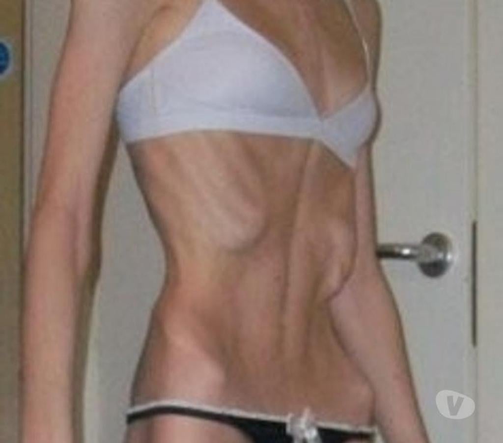 exhib Liège Liège-Centrum - Photos Vivastreet Cherche une relation avec une fille très mince ou anorexiqu