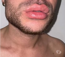 Mec Cherche Plan Suce Avec Grosse Bite Circoncise