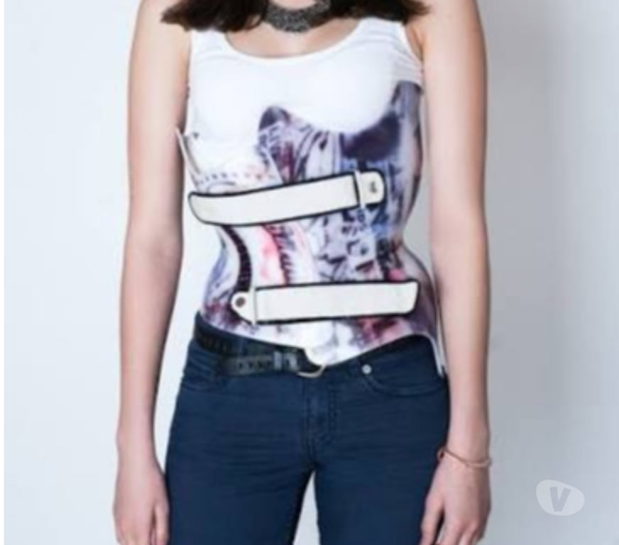 exhib Gembloux Gembloux-Centrum - Photos Vivastreet Pour fille avec corset scoliose orthopédique ou prothèse