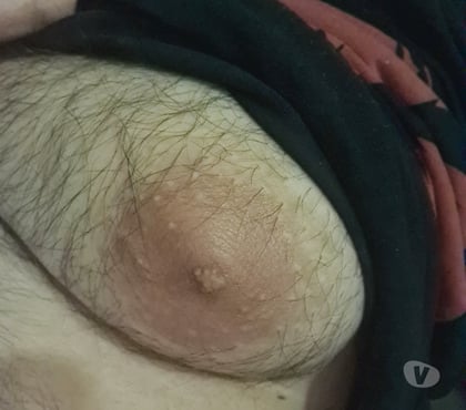 Gay - Photos Vivastreet Plan suce mutuelle maximum 35 ans