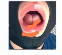 suceur expert pour rebeux