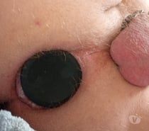 Cherche actif et fisteur