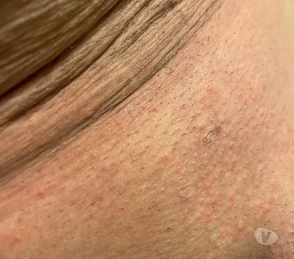 Gay Kaulen Welkenraedt - Photos Vivastreet Sans poil hihihi