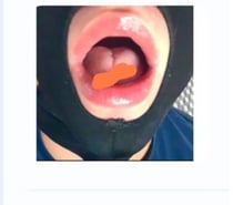 Suceur expert pour rebeux et renois