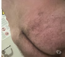 H poilu passif ch H mature actif