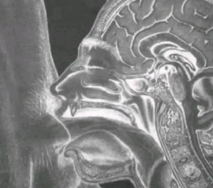 Gay Champion Namur - Photos Vivastreet Quelqu'un envie d'être sucé champion avant midi?