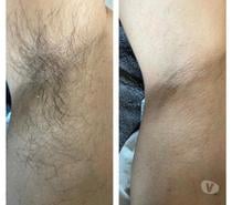 Épilation pour homme par esthéticienne