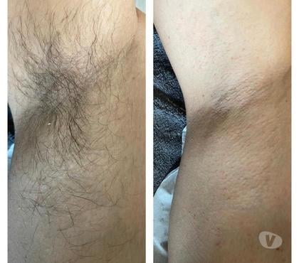 Autre Service Paris 12ème ardt Paris - Photos Vivastreet Épilation pour homme par esthéticienne