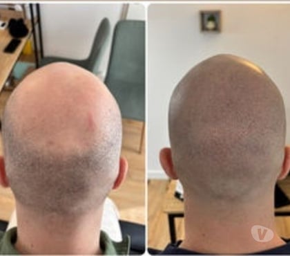 Castings, modèles, photographes Paris 13ème ardt Paris - Photos Vivastreet Recherche modèle homme pour tricopigmentation gratuite