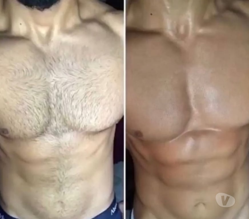 Autre Service Alpes-Maritimes Le Cannet - 06110 - Photos Vivastreet Epilation, pour homme