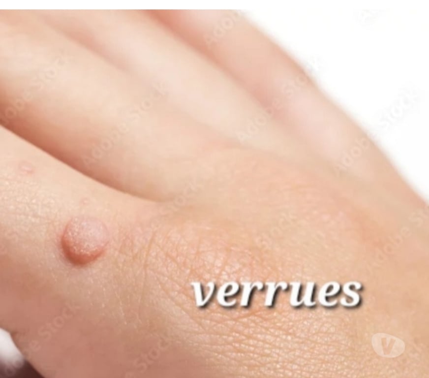 Autre Service Lot-et-Garonne Aiguillon - 47190 - Photos Vivastreet Magnétiseuse - Guérisseuse - 47