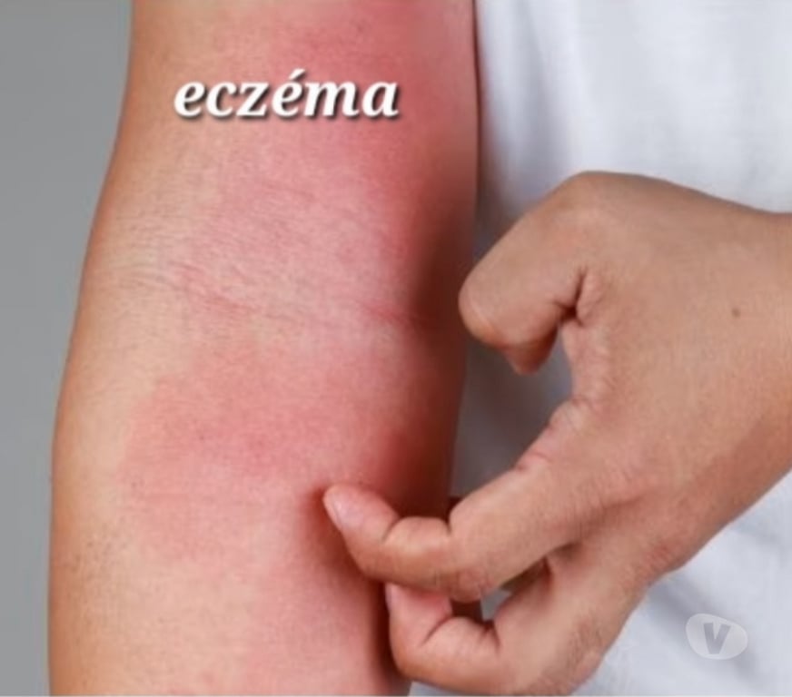 Autre Service Lot-et-Garonne Aiguillon - 47190 - Photos Vivastreet Magnétiseuse - Guérisseuse - Coupeuse de feu - 47