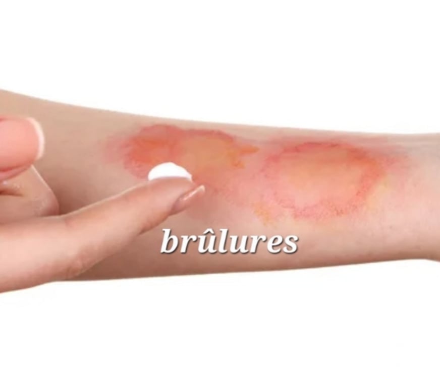 Autre Service Lot-et-Garonne Aiguillon - 47190 - Photos Vivastreet Magnétiseuse - Guérisseuse - Coupeuse de feu - 47