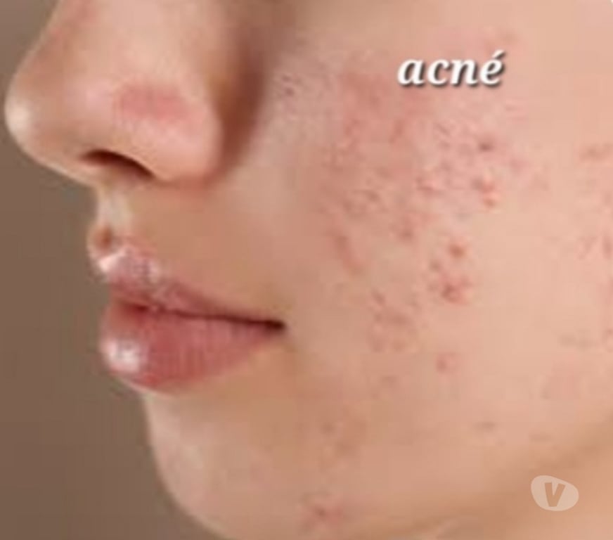 Autre Service Lot-et-Garonne Aiguillon - 47190 - Photos Vivastreet Magnétiseuse - Guérisseuse - Coupeuse de feu - 47