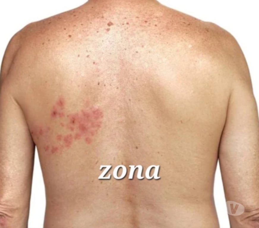 Autre Service Lot-et-Garonne Aiguillon - 47190 - Photos Vivastreet Magnétiseuse - Guérisseuse - Coupeuse de feu - 47