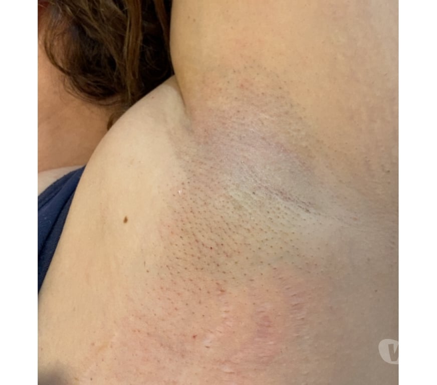 Massages Paris Paris 14ème ardt - 75014 - Photos Vivastreet Massage bien-être épilation homme et femme