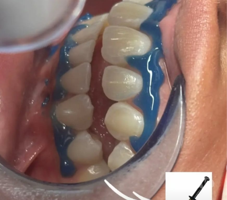 Autre Service Val-d'Oise Argenteuil - 95100 - Photos Vivastreet Sourire Hollywood