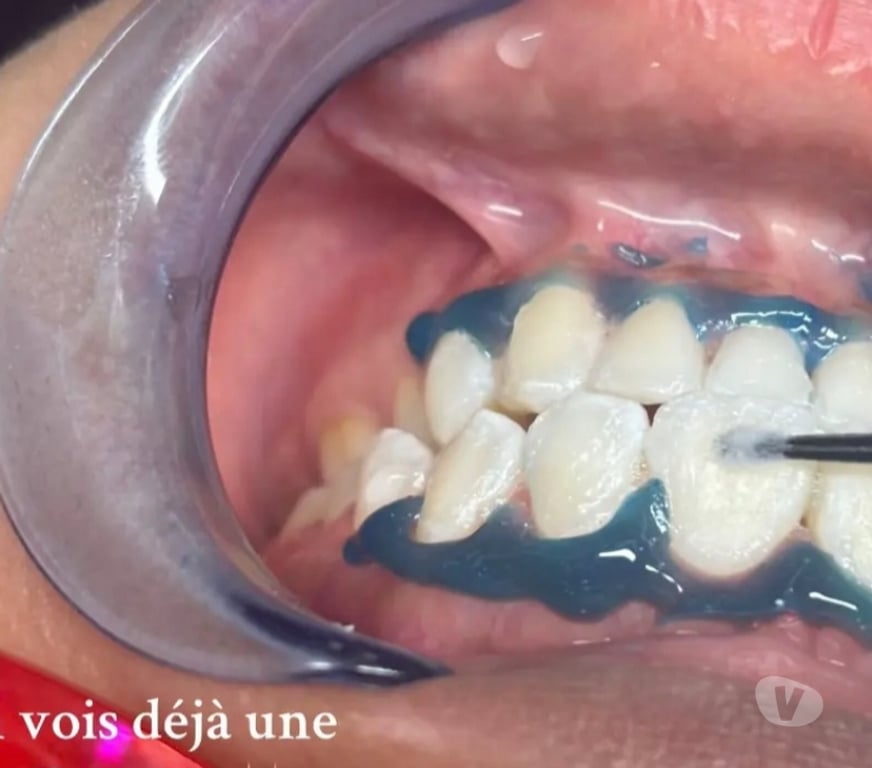 Autre Service Val-d'Oise Argenteuil - 95100 - Photos Vivastreet Sourire Hollywood