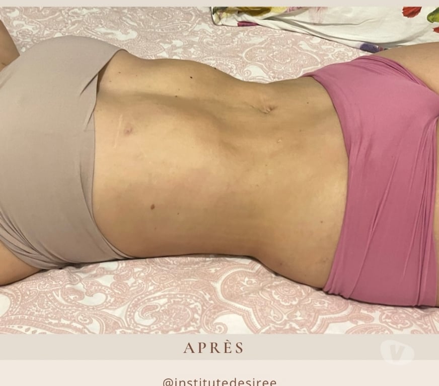 Massages Alpes-Maritimes Cannes - 06400 - Photos Vivastreet Massages Thérapeutiques - Drainage Lymphatique