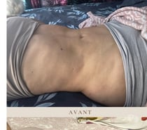 Massages Thérapeutiques - Drainage Lymphatique