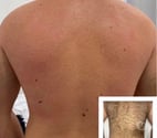 EPILATION POUR LES FEMMES ET LES HOMMES