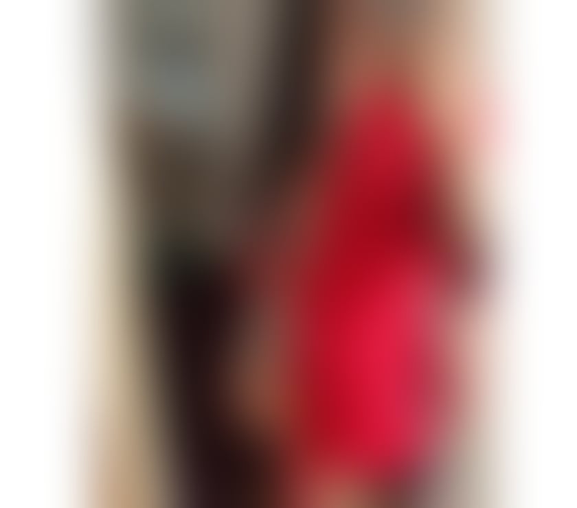 Trans Escorts Kent Medway - Kent - Photos for Nycolle – The Temptation You’ve Been Looking For