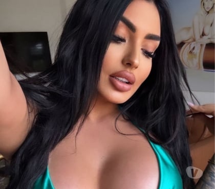 Escorts Dagenham Barking and Dagenham - Photos for 🍓 💕⭐MARY STAR THE BEST EXPERIENCE AVIALABE NOW 🍓