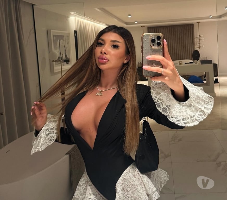 Escorts Kent Medway - Kent - Photos for ✨💫SEXY CHLOE💋FIRST CLASS SERVICES💫NEW