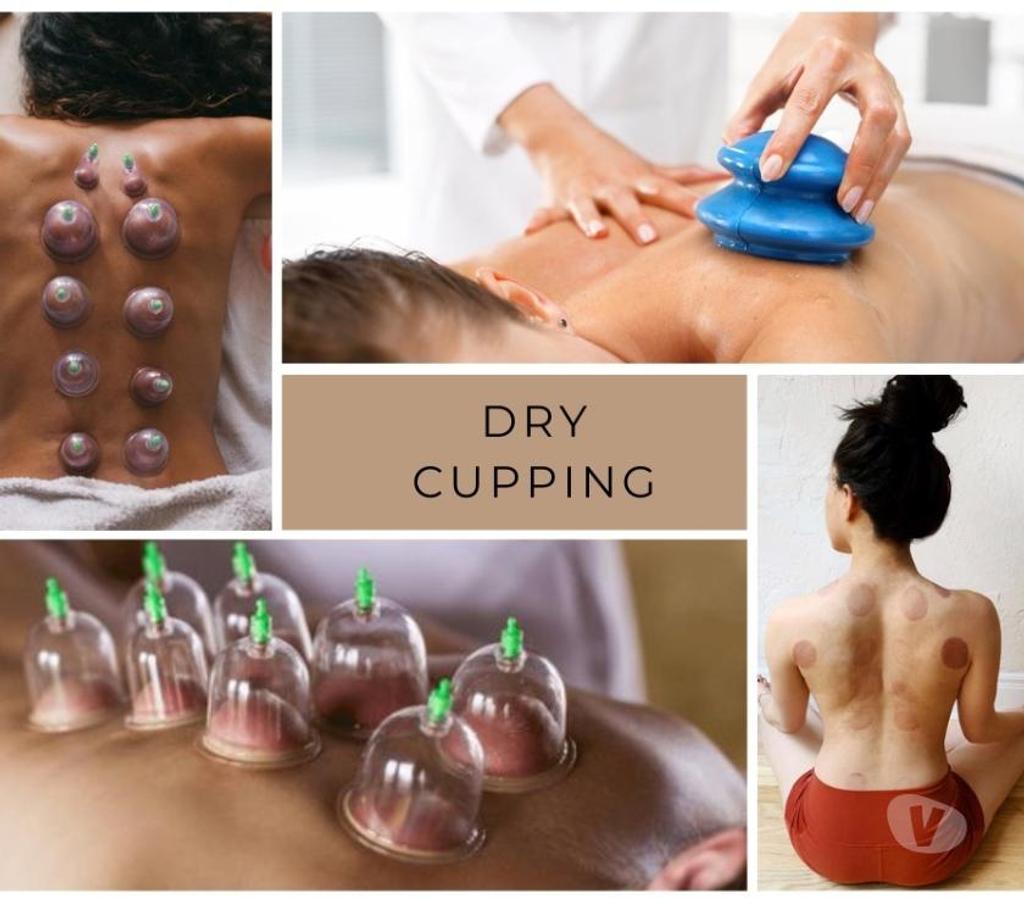 Full body massage Bedfordshire Luton - Photos for Mobile Ladies only Cupping Massage Therapy Outcall