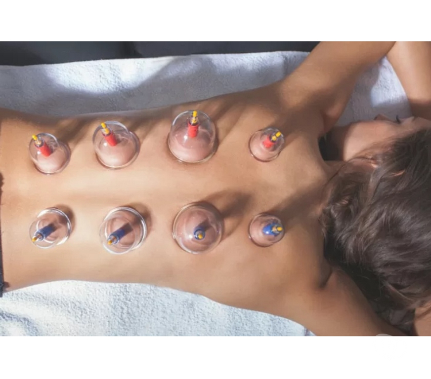 Full body massage Bedfordshire Luton - Photos for Mobile Ladies only Cupping Massage Therapy Outcall