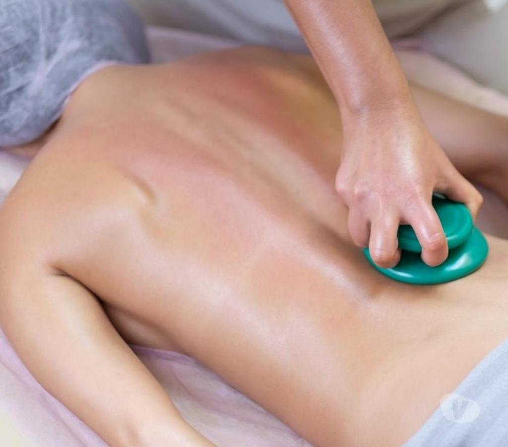 Full body massage Bedfordshire Luton - Photos for Mobile Ladies only Cupping Massage Therapy Outcall