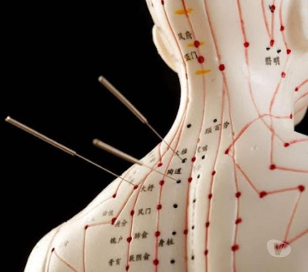 Full body massage Essex Epping Forest - Photos for Massage, Acupuncture, Reflexology, Cupping, Herbal in Debden