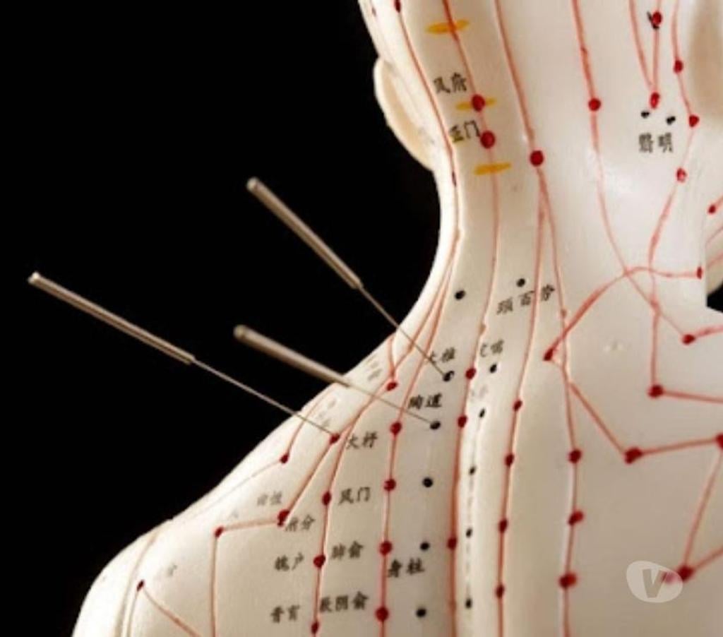 Full body massage Essex Epping Forest - Photos for Massage, Acupuncture, Reflexology, Cupping, Herbal in Debden