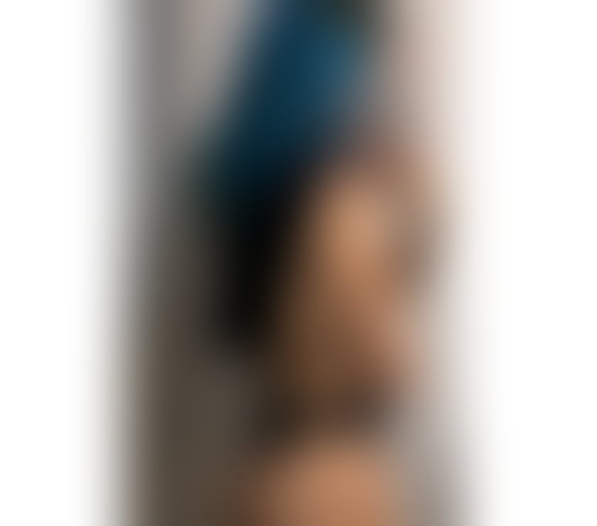 Escorts South East London Bellingham - South East London - Photos for LAURA 🍾PARTY 🥂 🤩 ❤️ NEW IN TOWN