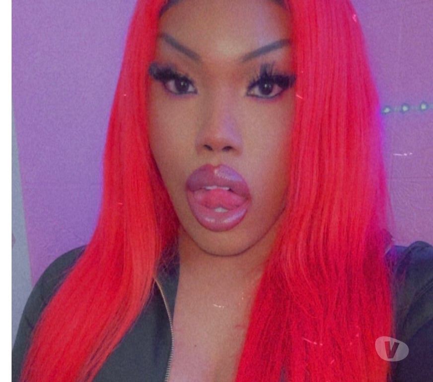 Trans Escorts West Yorkshire Leeds - Photos for 🍃Ts kylie xxx 🇩🇲 In Harehills