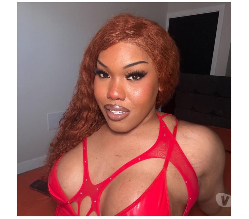 Trans Escorts West Yorkshire Leeds - Photos for 🍃Ts kylie xxx 🇩🇲 In Harehills