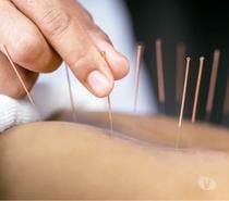 Acupuncture,Massage,Herbal Clinic in Loughton Debden Station