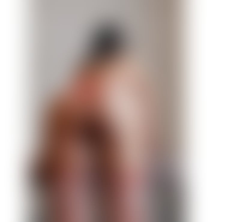 Escorts Kent Medway - Kent - Photos for 💎Escape into Pleasure B2B Bliss With an massage💎