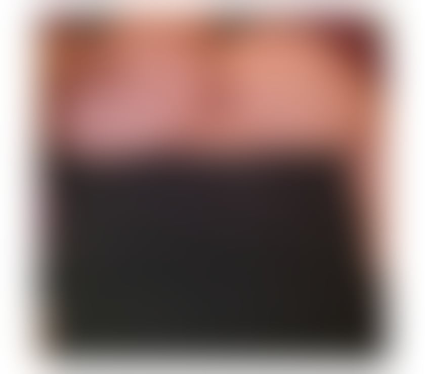 Escorts Kent Medway - Kent - Photos for 💎Escape into Pleasure B2B Bliss With an massage💎