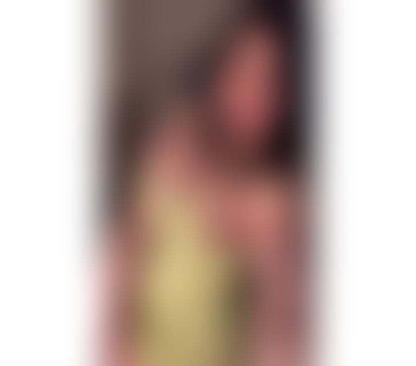 Escorts Haghill Glasgow - Photos for BEST ESCORT IN YOUR AREA🔥OUTCALL ONLY🔥PARTY