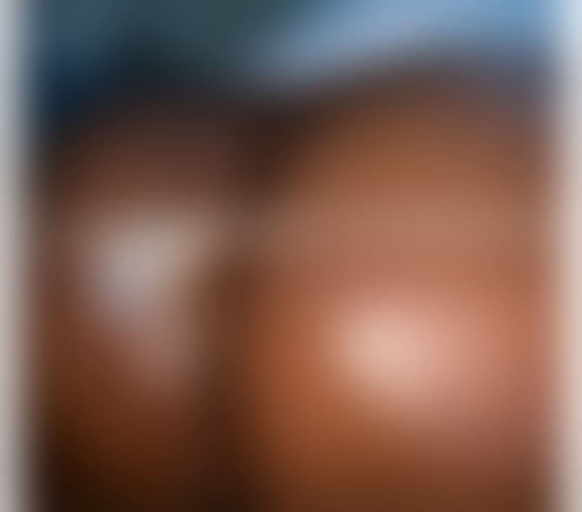 Escorts Dalston East London - Photos for (OUTCALL- OWO) BBW Only-Fans Girl 🍒NEW GIRL🍒🇧🇧