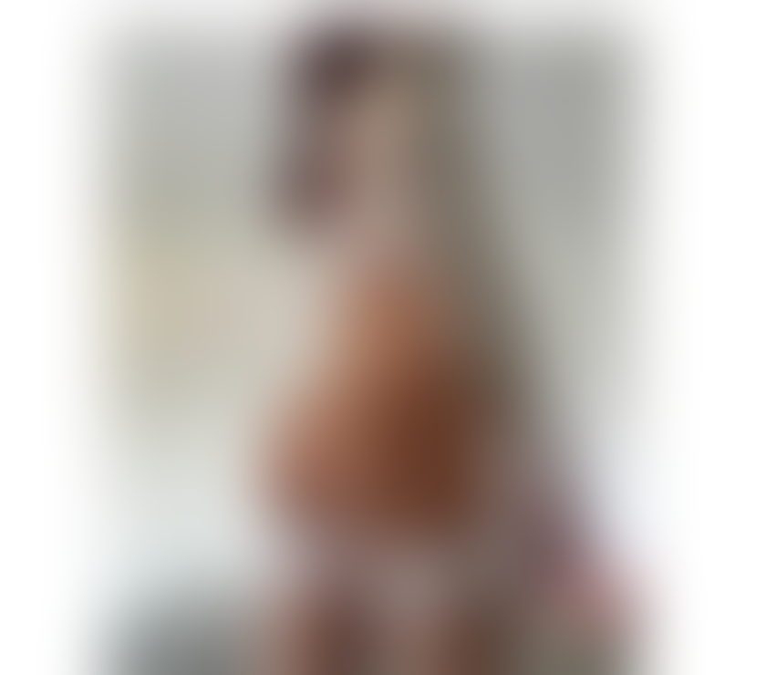 Escorts Kent Medway - Kent - Photos for LEXY FITT BODY Xxx