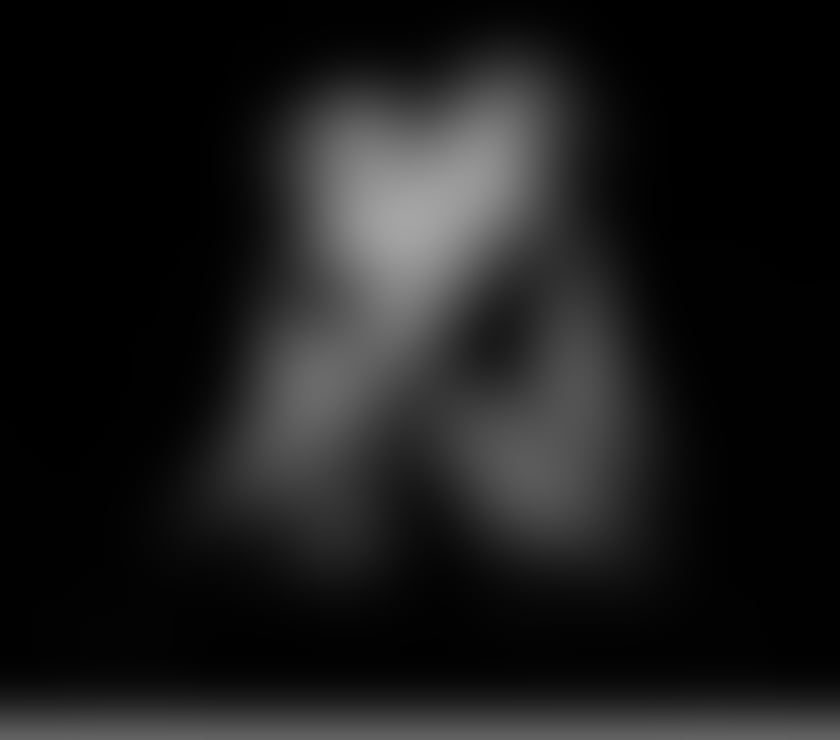 Escorts Edinburgh Edinburgh - Edinburgh - Photos for 🔥FULL BODY MASSAGE for LADIES Only ~ By MALE Masseur