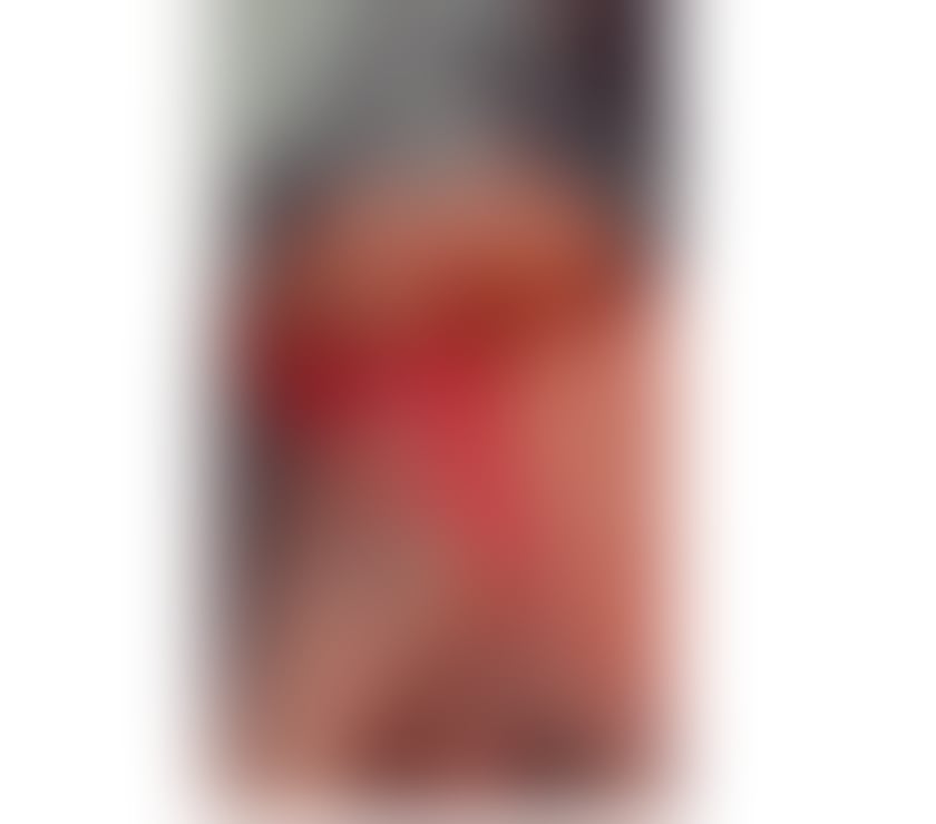 Trans Escorts West Midlands Birmingham - Photos for 🇩🇲💦Xx TS Kylie xX 🇩🇲💦