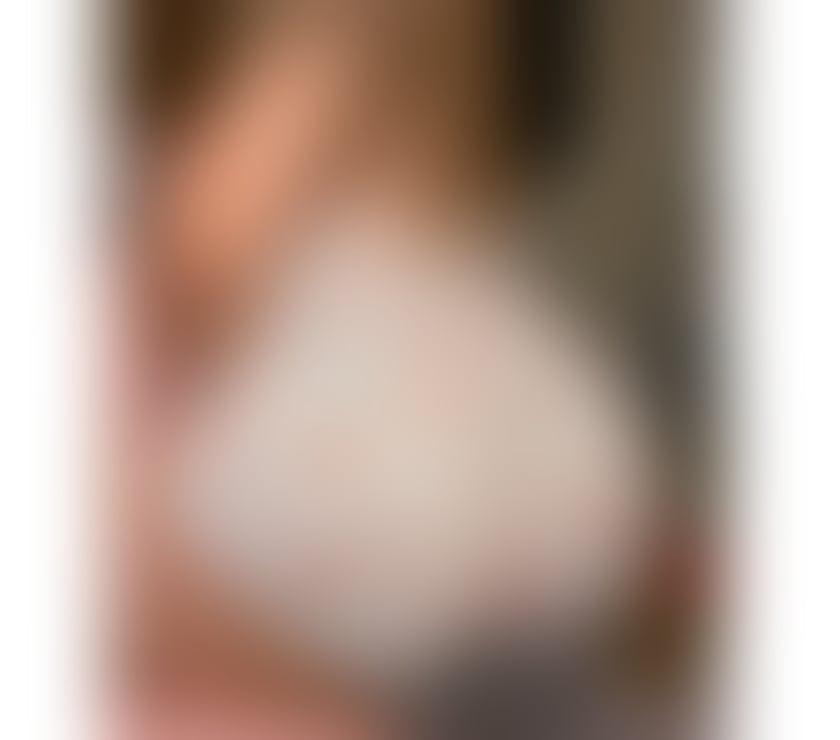 Trans Escorts Glasgow Glasgow Business Park - Glasgow - Photos for Same day appointment