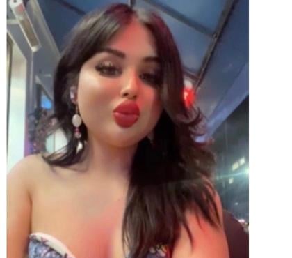 Trans Escorts Glasgow Business Park Glasgow - Photos for Same day appointment