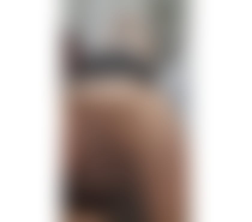 Escorts Derry and Strabane Londonderry - Derry and Strabane - Photos for 💯KING SERVICE💕TOP CLASS Massage & Escort💕💯