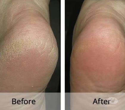 Massage Westcliff-on-Sea Southend-on-Sea - Photos for ESSEX PEDICURES & MASSAGE IN WESTCLIFF NON SMOKERS SS0