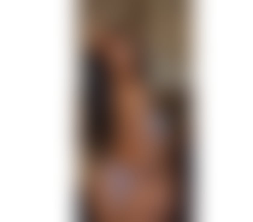 Escorts Wrexham - Wales Wrexham City Centre - Wrexham - Photos for 🔥BEAUTIFUL-BODY- NEW IN TOWN🏤