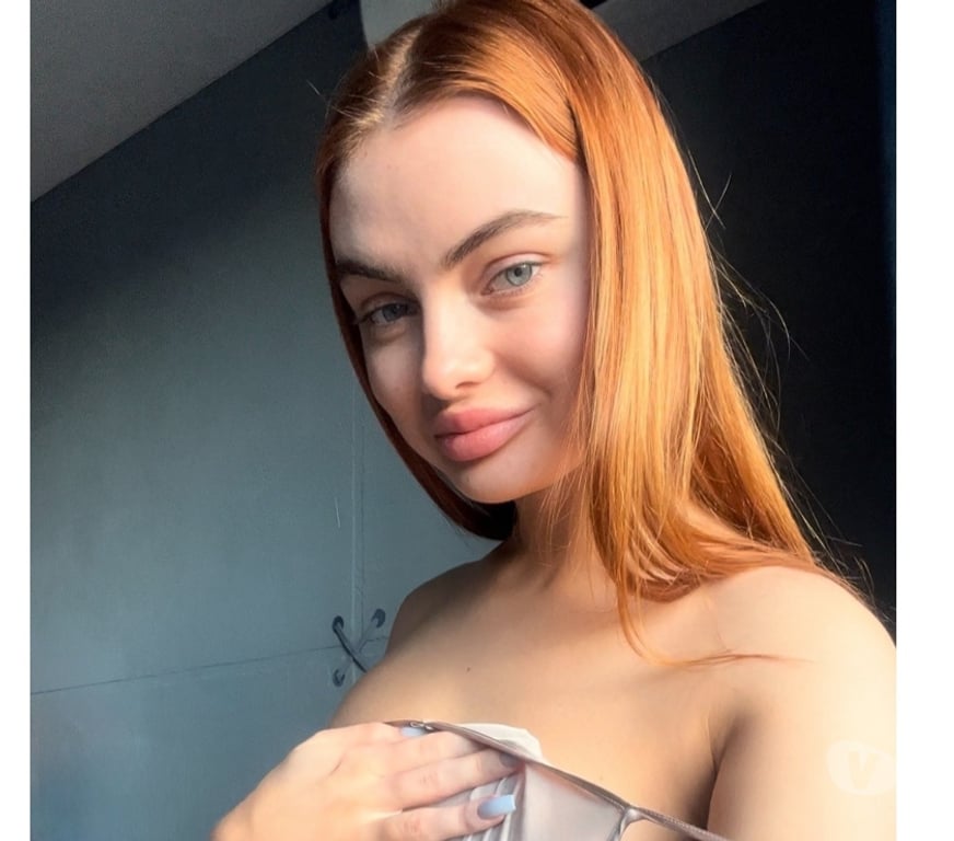 Adult Entertainment East London London Fields Station - East London - Photos for super cute girl 🌺 whatsapp, telegram💋 +44 7554 868004